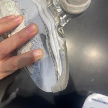 Premium Skechers Shoes Turn to Shreds in Just Four Months