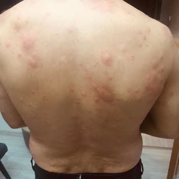 Atabay İlaç Firması Sigara Bırakma İlacı Qsmok 150 Mg