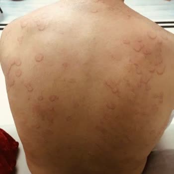 Atabay İlaç Firması Sigara Bırakma İlacı Qsmok 150 Mg