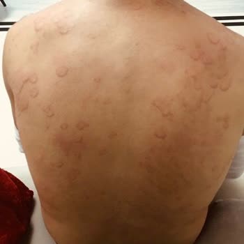 Atabay İlaç Firması Sigara Bırakma İlacı Qsmok 150 Mg