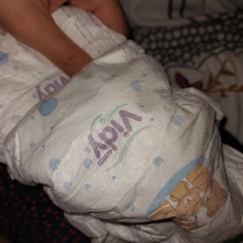 Vidy Baby Bebek Bezi Cırtları Sorunlu