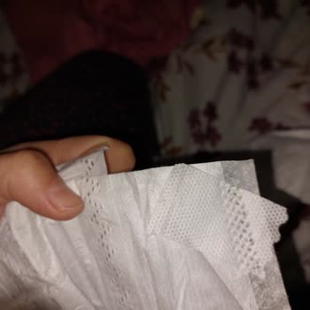 Vidy Baby Bebek Bezi Cırtları Sorunlu