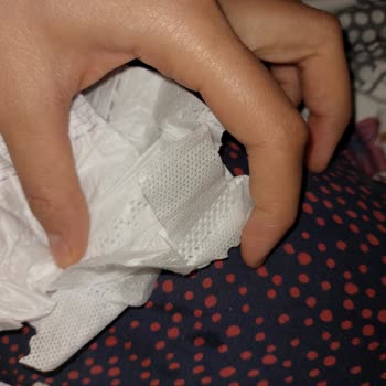 Vidy Baby Bebek Bezi Cırtları Sorunlu