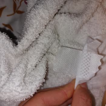 Vidy Baby Bebek Bezi Cırtları Sorunlu