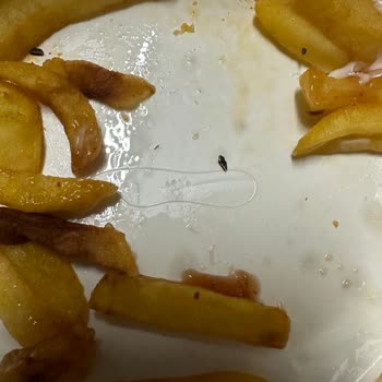 Köfteci Yusuf Patates Kızartmasından Çıkan Kıl