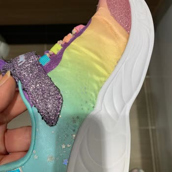 Skechers 2 Aylık Ayakkabının Deformasyonu