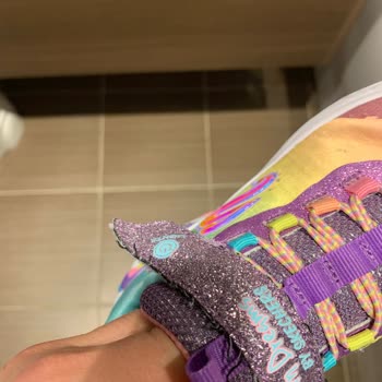 Skechers 2 Aylık Ayakkabının Deformasyonu