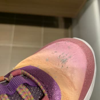Skechers 2 Aylık Ayakkabının Deformasyonu