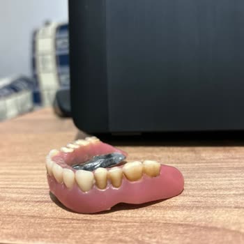 Deniz Yiğit Diş Polikliniği İmplant Sonrası Dişlerde Meydana Gelen Renk Değişikliği Ve Hizmet Kalitesi Sorunları