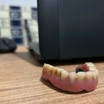 Deniz Yiğit Diş Polikliniği İmplant Sonrası Dişlerde Meydana Gelen Renk Değişikliği Ve Hizmet Kalitesi Sorunları