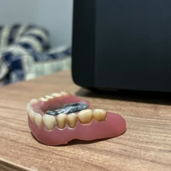 Deniz Yiğit Diş Polikliniği İmplant Sonrası Dişlerde Meydana Gelen Renk Değişikliği Ve Hizmet Kalitesi Sorunları