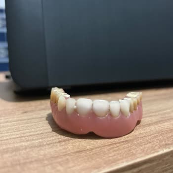 Deniz Yiğit Diş Polikliniği İmplant Sonrası Dişlerde Meydana Gelen Renk Değişikliği Ve Hizmet Kalitesi Sorunları