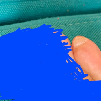 Skechersten Müşteri Memnuniyeti İçin Çözüm Bekliyorum