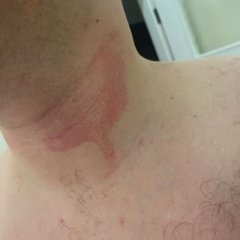 Gillette Yüzü Tahriş Etmesi