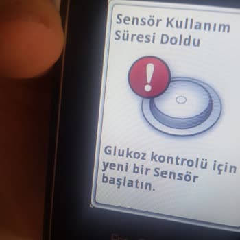Freestyle Libre Şeker Ölçüm Hatası Veriyor