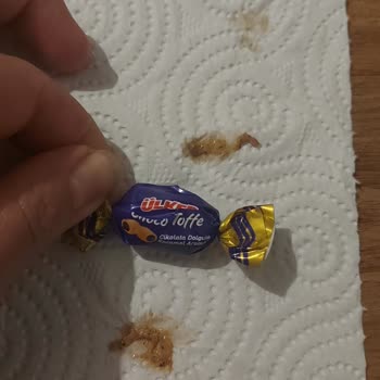 Ülker Choco Toffe Şeker Den Yabancı Cisim Çıktı
