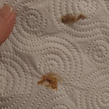 Ülker Choco Toffe Şeker Den Yabancı Cisim Çıktı