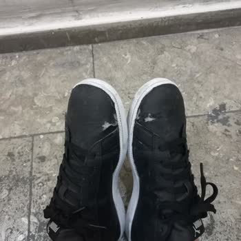 Sağlık Bakanlığı  Çam Sakura Sorunu