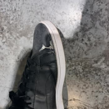 Sağlık Bakanlığı  Çam Sakura Sorunu