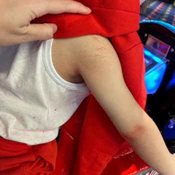 H&M İçi Polarlı Ürünler Çocuğumun Cildine Pamukçuk Bırakıyor