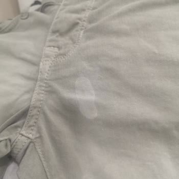 Vanish Kosla Yüzünden Pantolonum Beyazladı.