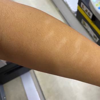 Nurcan Kaplan Beauty Lazer Yaparken Kolumu Yaktılar