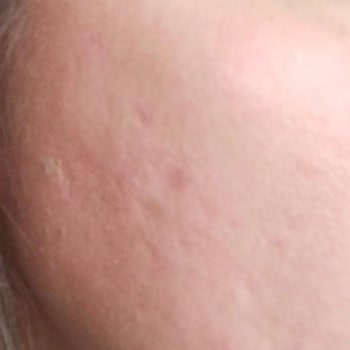 Adolya Estetik Adolya Meram Şubesi Yalanı