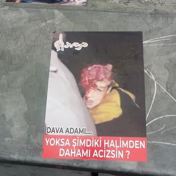 Konya Büyükşehir Belediyesi Uygunsuz Ve Şiddet İçerikli Afiş