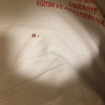 Ümraniye Eğitim ve Araştırma Hastanesi Temizlik Sorunları Biri Aştı