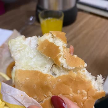 Burger King Burgerimde Eldiven Çıktı