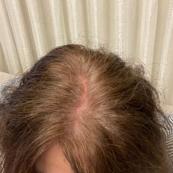 Loreal Paris Beklentiyi Karşılamayan Saç Boyası Hayal Kırıklığı