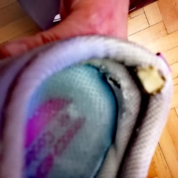 Skechers Kalitesiz Ürün Hayal Kırıklığı Yarattı