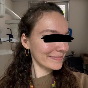 iPhone 15 Plus Ön Kamera Fotoğrafları Değiştiriyor