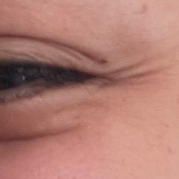 Novar Poliklinikleri Pişmanlıktır