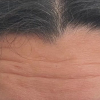 Novar Poliklinikleri Pişmanlıktır