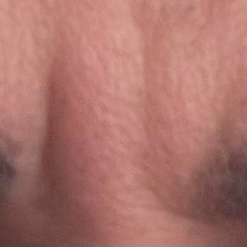 Novar Poliklinikleri Pişmanlıktır