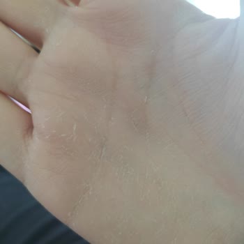Duru Sabun Vanilyalı Sabun El Kabuklanması Yaptı!