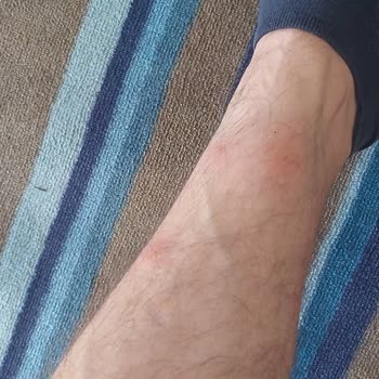 Pine Bay Holiday Resort Balayı Kabusa Dönüştü!