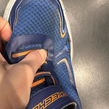 Skechers Ayakkabı 2 Ayda Her İki Ayakkabıda Açılma Oldu.