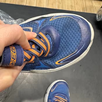 Skechers Ayakkabı 2 Ayda Her İki Ayakkabıda Açılma Oldu.