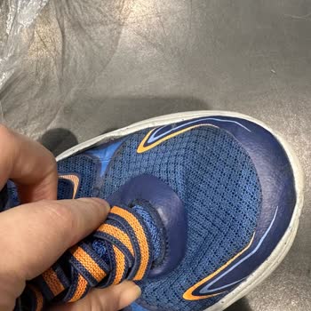 Skechers Ayakkabı 2 Ayda Her İki Ayakkabıda Açılma Oldu.