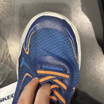 Skechers Ayakkabı 2 Ayda Her İki Ayakkabıda Açılma Oldu.