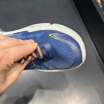 Skechers Ayakkabı 2 Ayda Her İki Ayakkabıda Açılma Oldu.