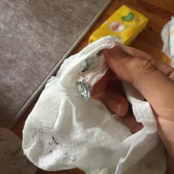 Dalin Islak Mendilin İçinden Yapışkan Alüminyum Folyo Çıktı