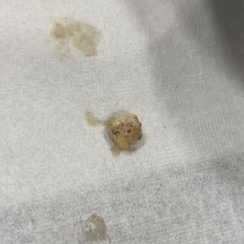 Kredi ve Yurtlar Kurumu Uluşehir Kız Yurdu Kurtlu Yemekler