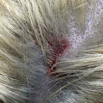 Palette Saç Derisi Yandı