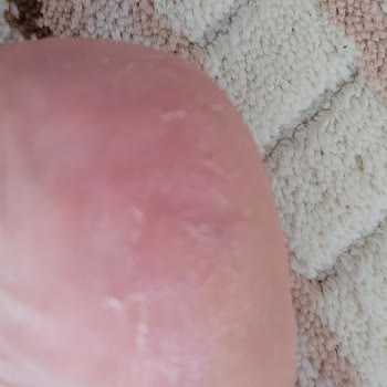 Bostancı El Ayak Ve Bakım Merkezi İlgisizliği
