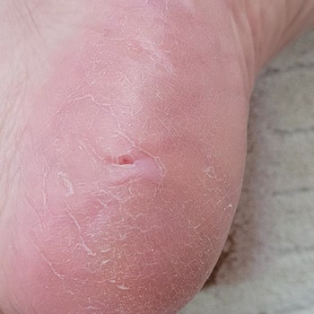 Bostancı El Ayak Ve Bakım Merkezi İlgisizliği