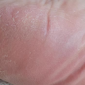 Bostancı El Ayak Ve Bakım Merkezi İlgisizliği