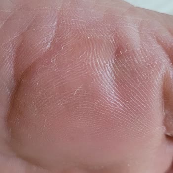 Bostancı El Ayak Ve Bakım Merkezi İlgisizliği